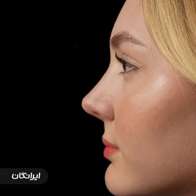 دکتر حسین زادی