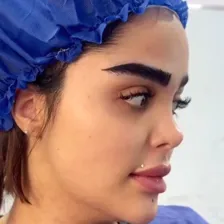 کلینیک کاشت مو غربی