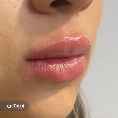 کلینیک زیبایی آبگینه