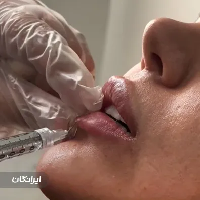 کلینیک زیبایی دکتر مرضیه علیزاده