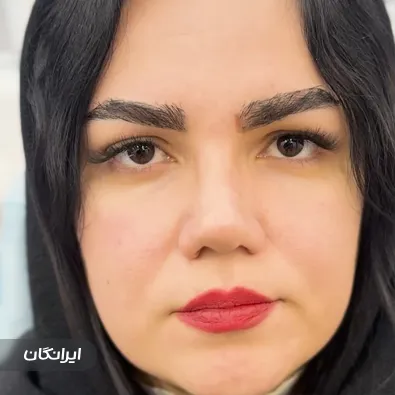 کلینیک زیبایی هور