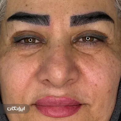 کارشناس کاشت ابرو شادی حسینی