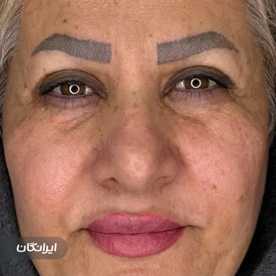 کارشناس کاشت ابرو شادی حسینی