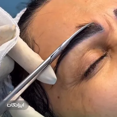 کارشناس کاشت ابرو شادی حسینی