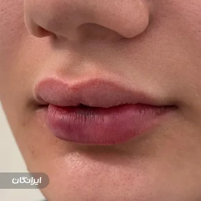 کلینیک زیبایی آسمان