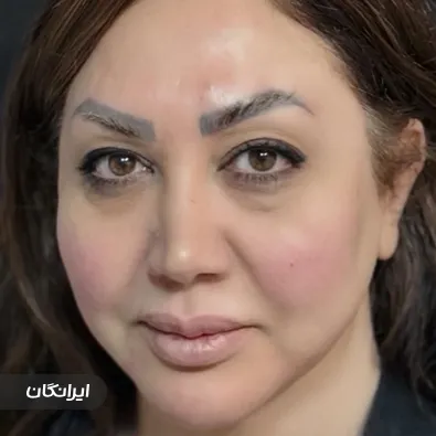 کلینیک زیبایی و لیزر نور