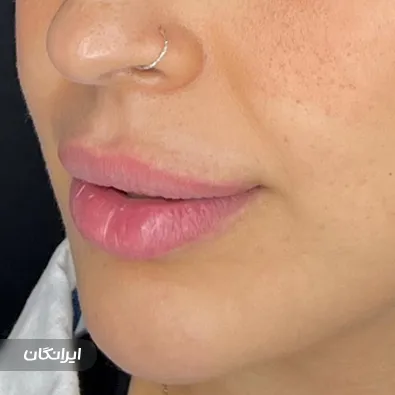 کلینیک زیبایی دکتر ایمان عباسی دینه کبودی