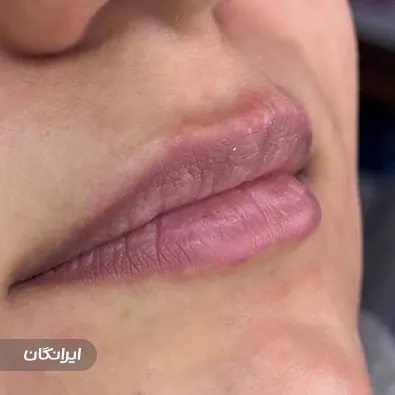 کلینیک زیبایی آفا