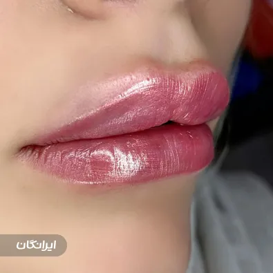 کلینیک زیبایی آفا