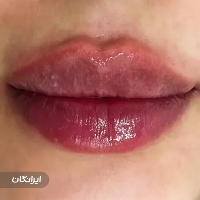 کلینیک زیبایی آنا