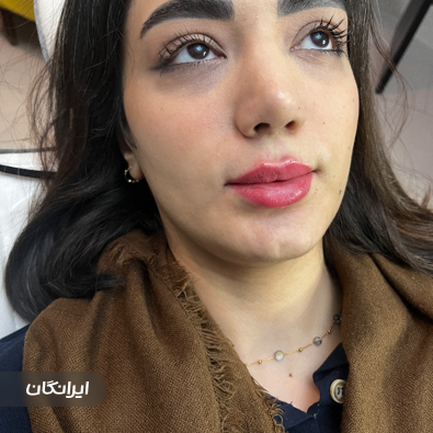 کلینیک زیبایی دیاموند