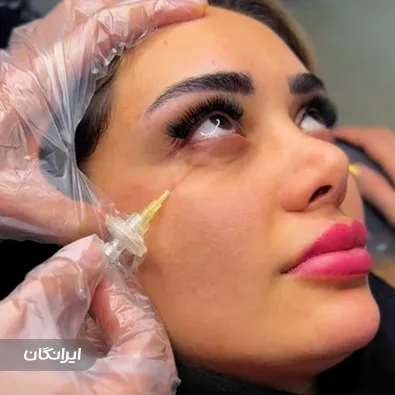 کلینیک زیبایی نیلسا