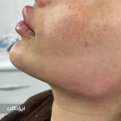 کلینیک زیبایی دکتر مرتضی نيک‌ پیام