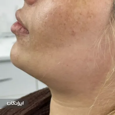 کلینیک زیبایی دکتر مرتضی نيک‌ پیام