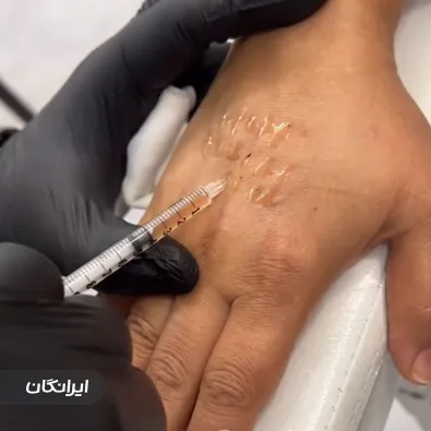 کلینیک زیبایی شارن