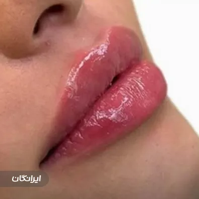 کلینیک زیبایی بل