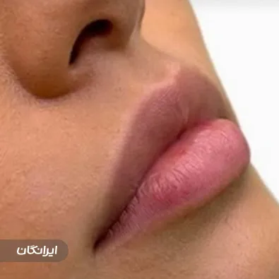 کلینیک زیبایی بل