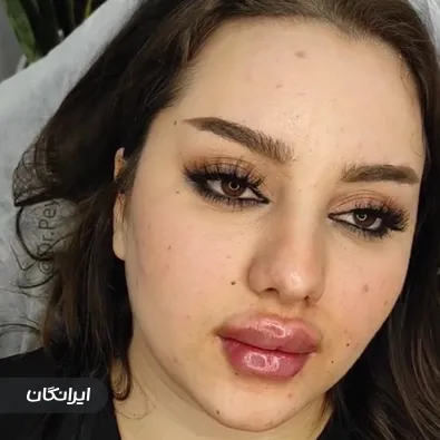 کلینیک زیبایی دکتر پیوند فرزان پور