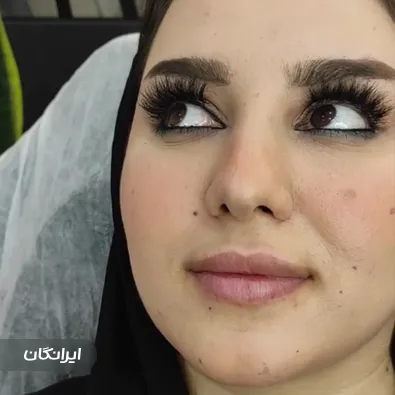 کلینیک زیبایی دکتر پیوند فرزان پور