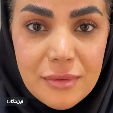 کلینیک زیبایی هانیتا
