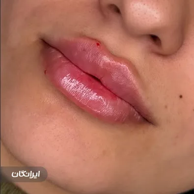 کلینیک زیبایی دکتر مریم فرزادی