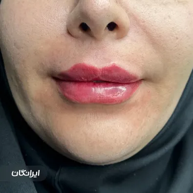 کلینیک زیبایی دکتر رامین کرمی