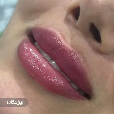 کلینیک زیبایی مهر