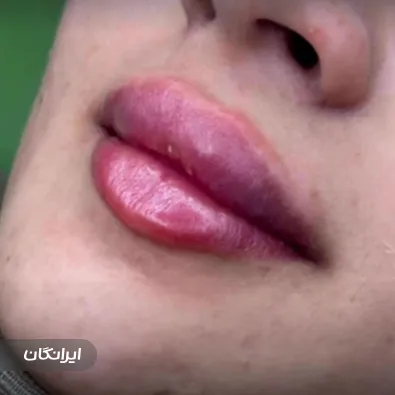 کلینیک زیبایی مهر