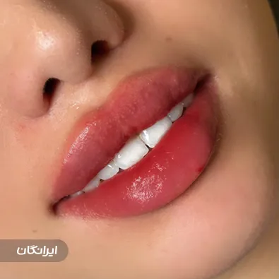 کلینیک زیبایی آتریسا