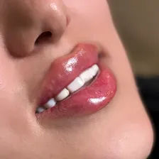 کلینیک زیبایی آتریسا