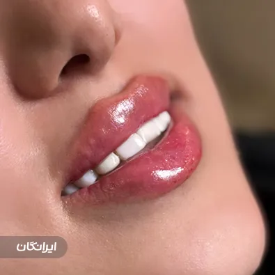 کلینیک زیبایی آتریسا