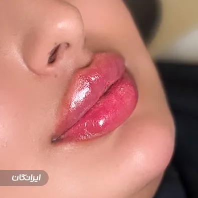 کلینیک زیبایی آتریسا