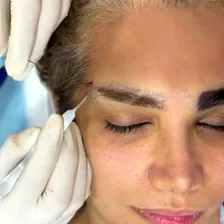 کارشناس کاشت مو شبنم رشیدی