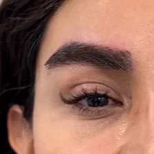 کارشناس کاشت مو میلاد غریب نواز