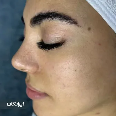 فیشیالیست ندا کشاورز رضوان