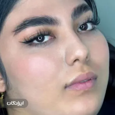 کلینیک زیبایی ملی ماه