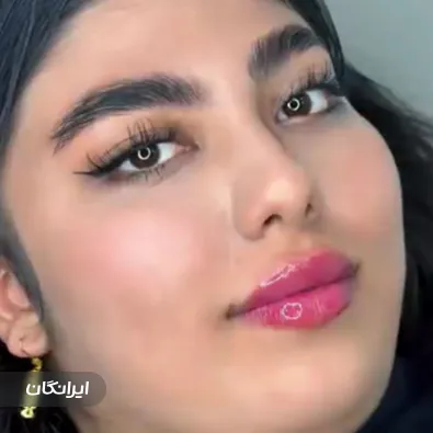 کلینیک زیبایی ملی ماه