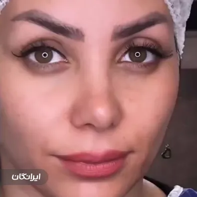 کلینیک رویال کاشت