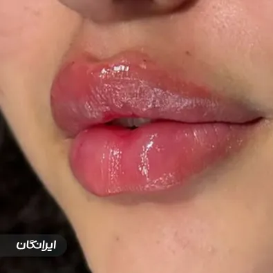 کلینیک زیبایی بلزا