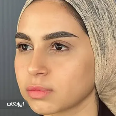 کلینیک زیبایی بلزا