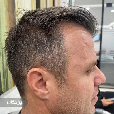 کلینیک زیبایی آرمو