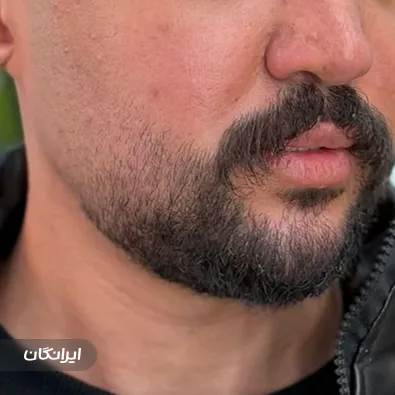 کلینیک زیبایی کاشف