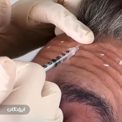 کلینیک زیبایی آتی ماه