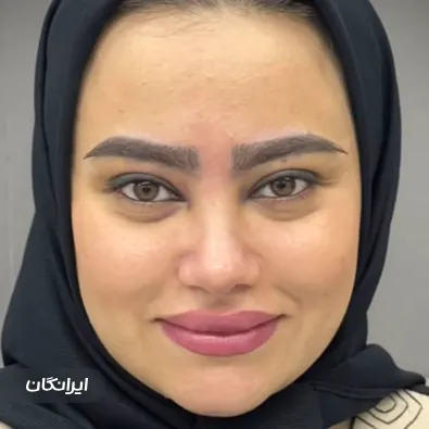 کلینیک کاشت مو خزائی