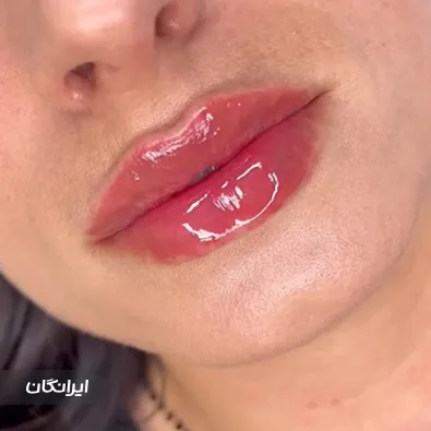 کلینیک زیبایی میلاد