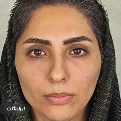 کلینیک زیبایی الی ماه