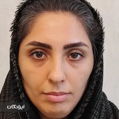 کلینیک زیبایی الی ماه