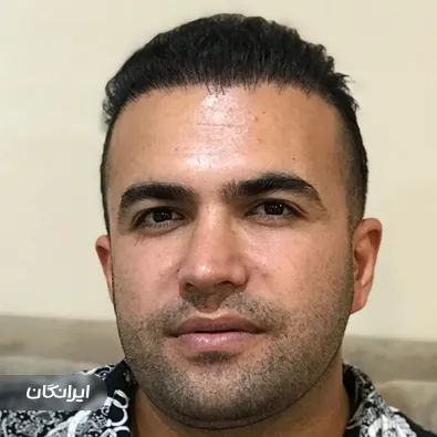 کلینیک کاشت مو و ابرو بهار