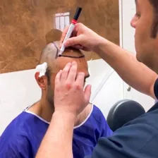 کلینیک کاشت مو و ابرو بهار