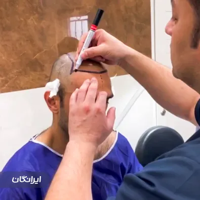 کلینیک کاشت مو و ابرو بهار